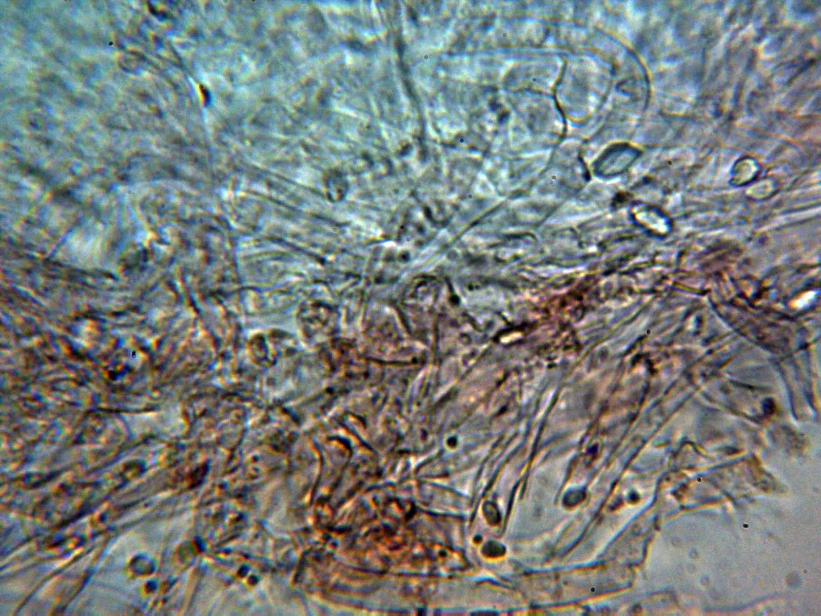 Microscopía de Leucogyrophana sororia - 10 - Hifas subiculares 2
